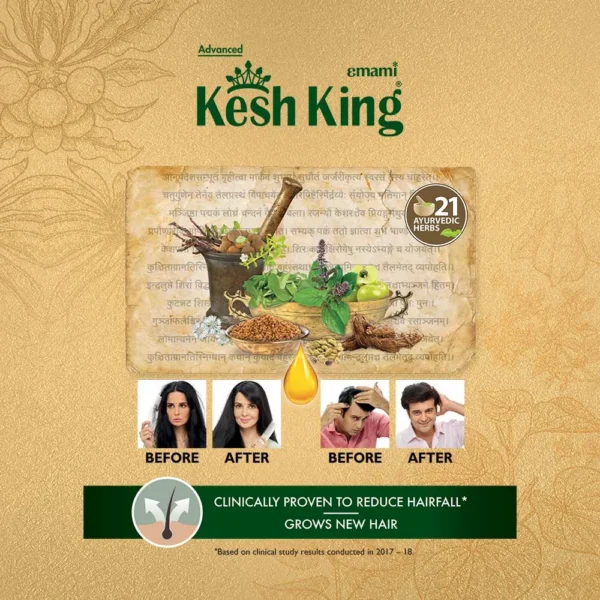 Kesh king scalp and hair medicine ayurvedic oil next